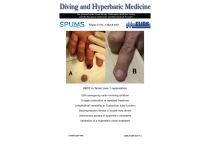 Diving and Hyperbaric Medicine Issue 1 Vol 53 2023